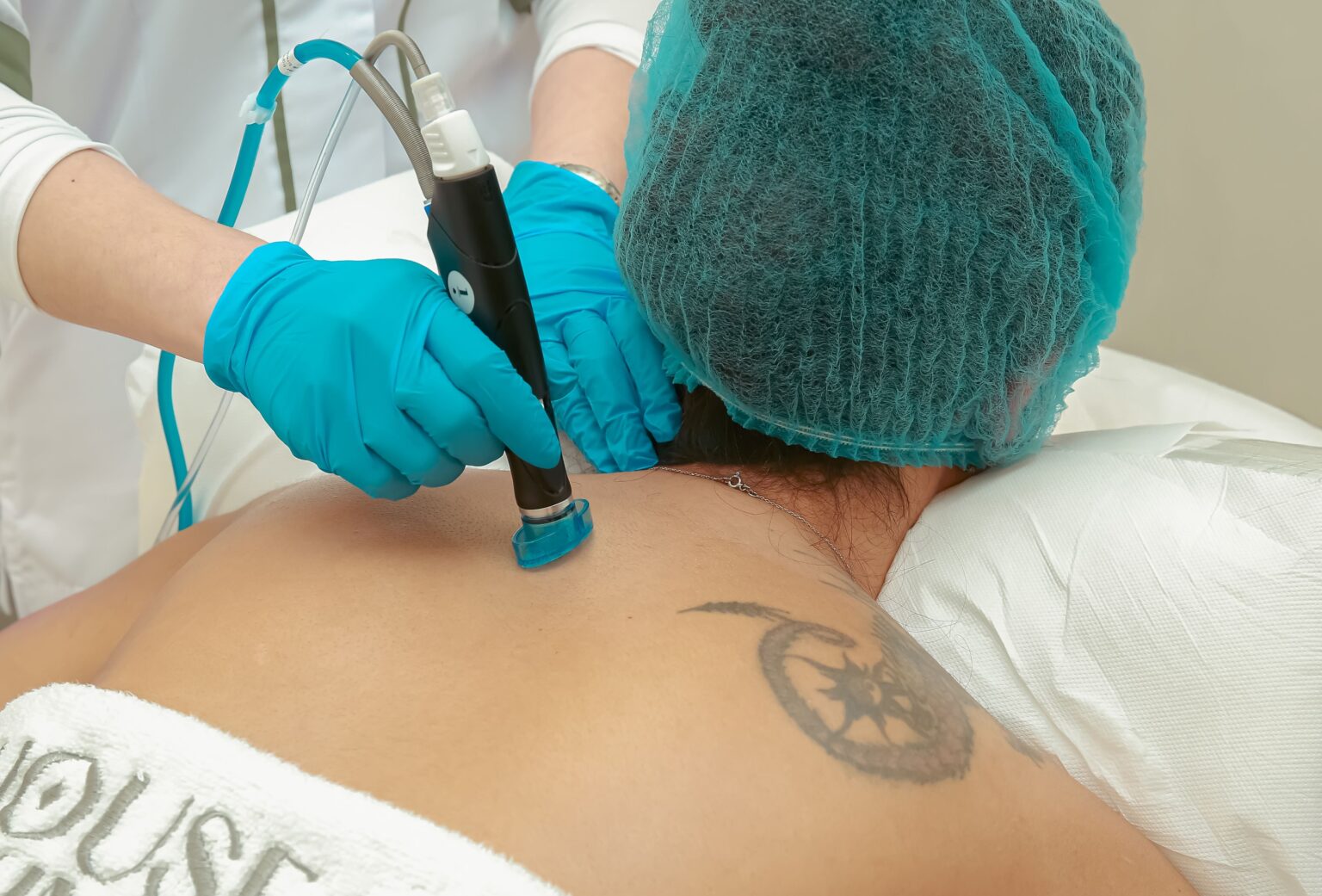 What to Do After Laser Tattoo Removal: A Guide to Proper Aftercare